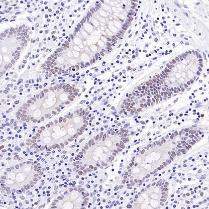 Caspase-8 Recombinant Rabbit mAb (S-2676-74)