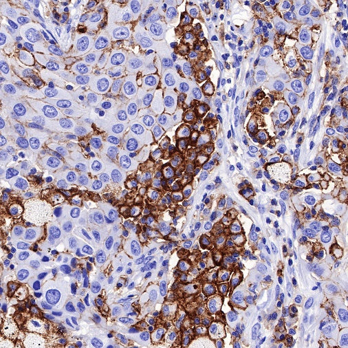CD44 Recombinant Rabbit mAb (SDT-R107)