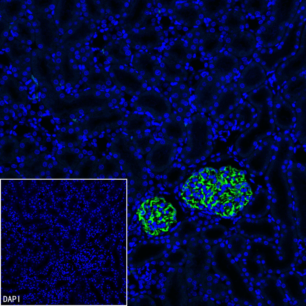 Nestin Recombinant Rabbit mAb (S-3890-61)