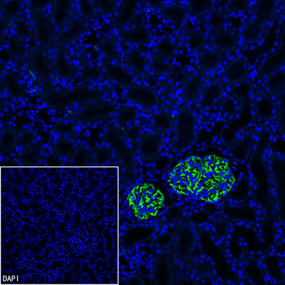 Nestin Recombinant Rabbit mAb (S-3890-61)