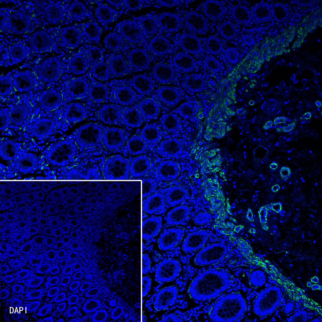 Myosin-11/SMMHC Recombinant Rabbit mAb,PBS Only (SDT-188-112)