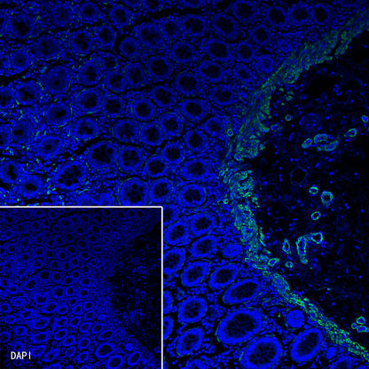 Myosin-11/SMMHC Recombinant Rabbit mAb,PBS Only (SDT-188-112)