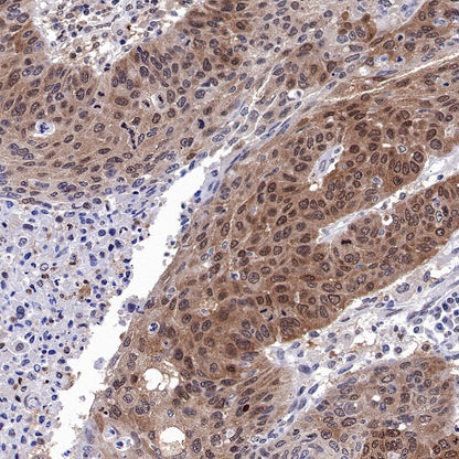 Stat3 Recombinant Rabbit mAb (S-1393-64)