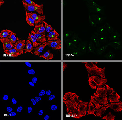 TGN46 Recombinant Rabbit mAb (S-3514-47)