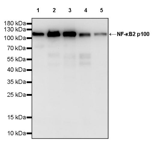 NF-κB2 p100 Recombinant Rabbit mAb (S-2502-62)