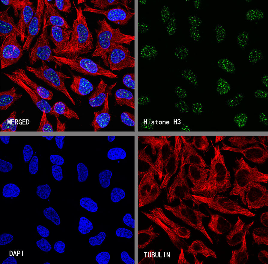 Histone H3 Recombinant Rabbit mAb (S-5672)