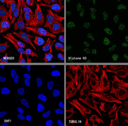 Histone H3 Recombinant Rabbit mAb (S-5672)