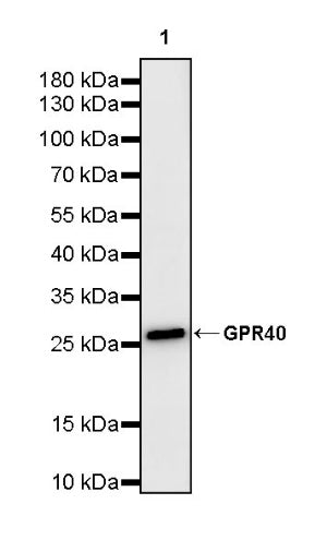 GPR40 Recombinant Rabbit mAb (S-3817-50)