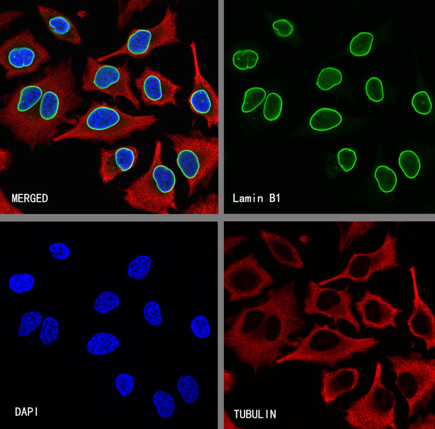 Lamin B1 Recombinant Mouse mAb (S-4865)