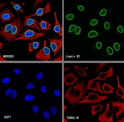 Lamin B1 Recombinant Mouse mAb (S-4865)