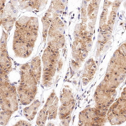 Argonaute-2 Recombinant Rabbit mAb (S-1826-47)
