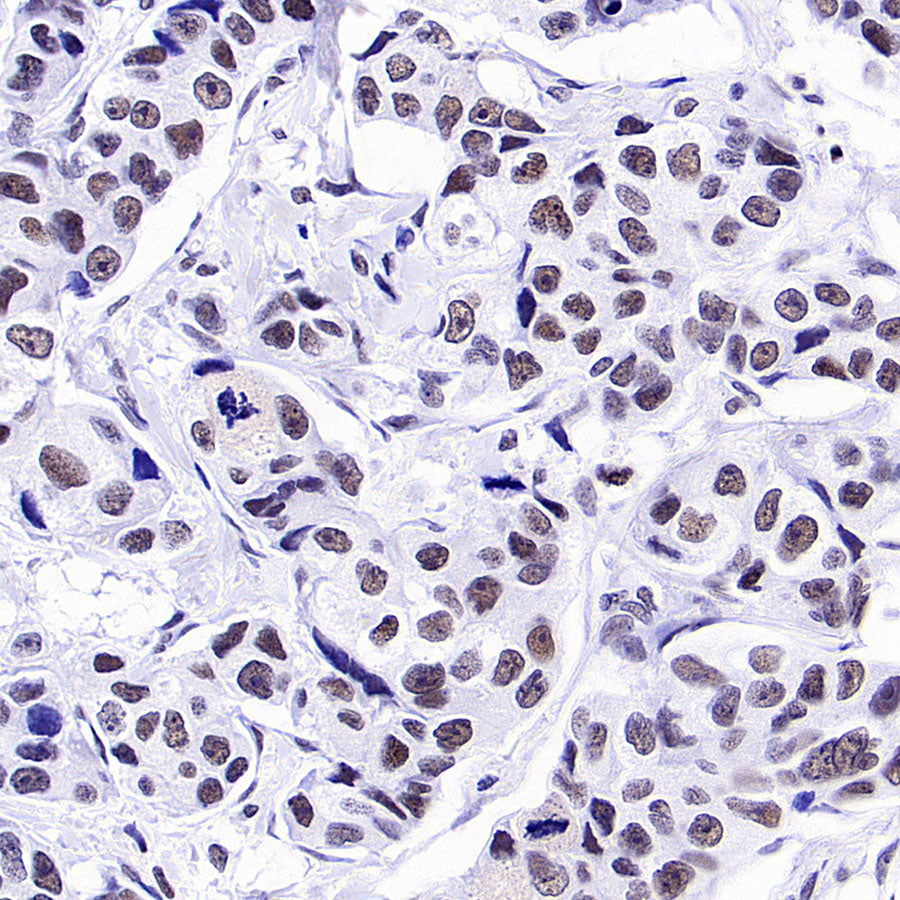 INI-1/SMARCB1 Recombinant Rabbit mAb (S-4068-21)