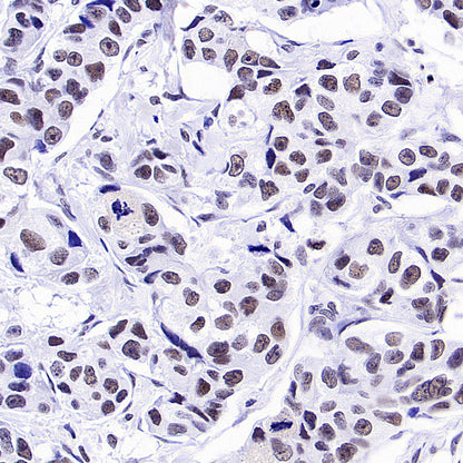 INI-1/SMARCB1 Recombinant Rabbit mAb (S-4068-21)