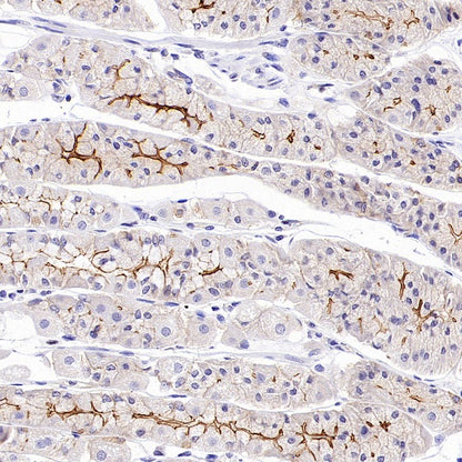 ZO-1 Recombinant Rabbit mAb (S-2188-12)