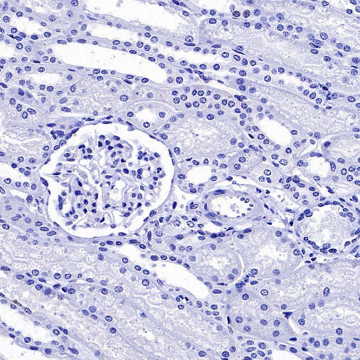 Somatostatin Receptor 2 Recombinant Rabbit mAb (SDT-2507-1)