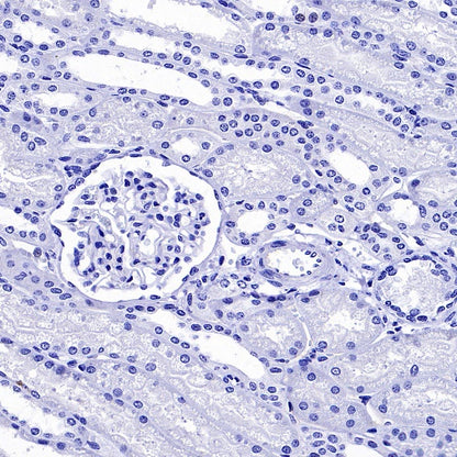 Somatostatin Receptor 2 Recombinant Rabbit mAb (SDT-2507-1)