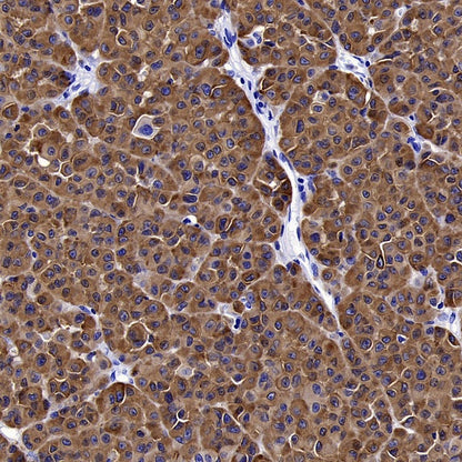 MelanA Recombinant Rabbit mAb (SDT-3352)