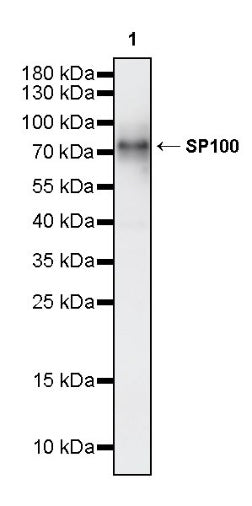 SP100 Rabbit Polyclonal Antibody