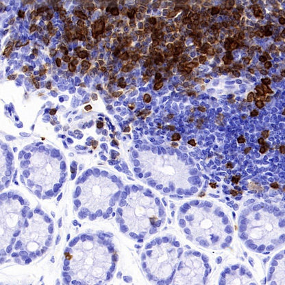 CD5 Recombinant Rabbit mAb (SDT-2570-53)