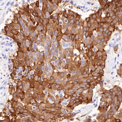 Glutamine Synthetase (GS) Recombinant Rabbit mAb (SDT-549-25)