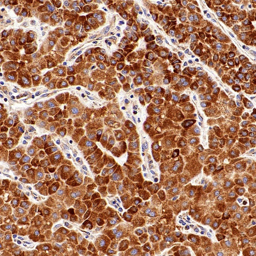 CPT1A Recombinant Rabbit mAb (S-1263-2)