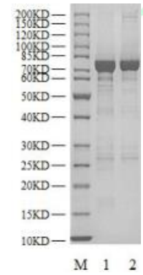 DAPK3 GST Tag Protein, Human