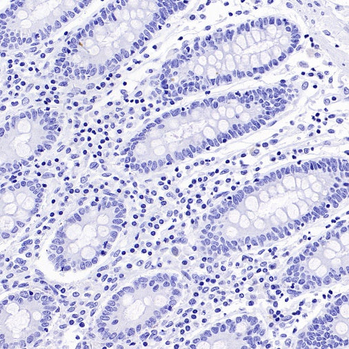 NKX3.1 Recombinant Rabbit mAb (S-2778-63)