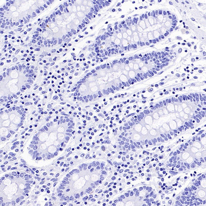 NKX3.1 Recombinant Rabbit mAb (S-2778-63)