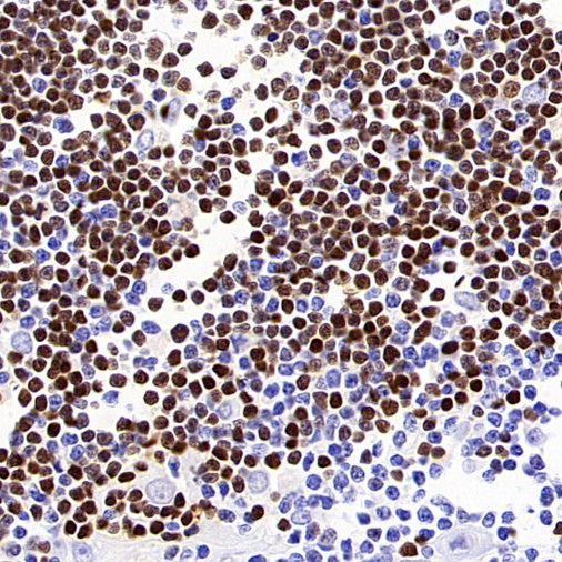 TdT Recombinant Mouse mAb (SDT-4203)