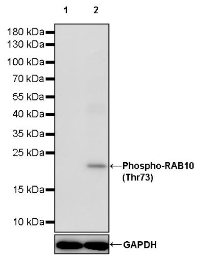 Phospho-RAB10 (Thr73) Recombinant Rabbit mAb (S-1687-8)