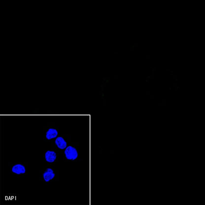 p120 Catenin Recombinant Rabbit mAb (SDT-350-75)