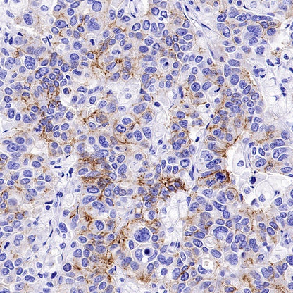 Claudin 3+Claudin 9 Recombinant Rabbit mAb (SDT-1452-80)