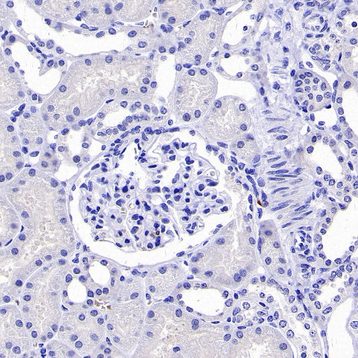 SOX11 Recombinant Mouse mAb (SDT-919-58)