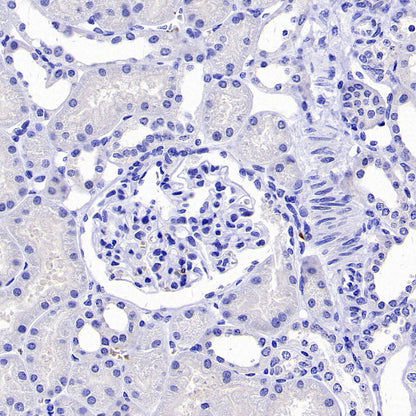 SOX11 Recombinant Mouse mAb (SDT-919-58)