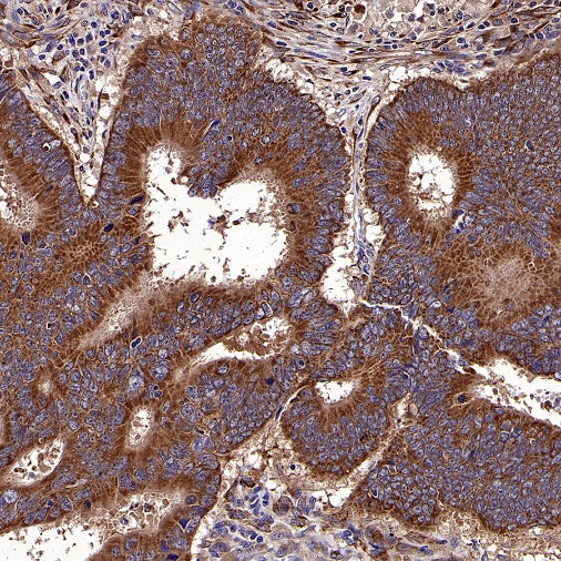 IGF2BP2 Rabbit Polyclonal Antibody