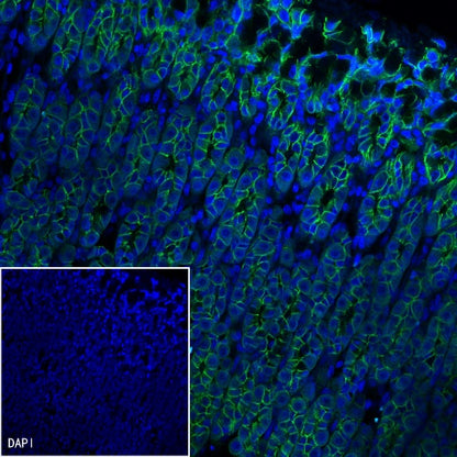 E-Cadherin Recombinant Rabbit mAb (FITC Conjugate) (S-438-5)