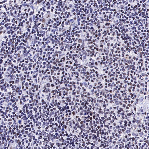 HMGB1 Recombinant Rabbit mAb (S-R305)