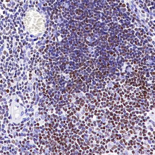 IKAROS Recombinant Rabbit mAb (S-R264)