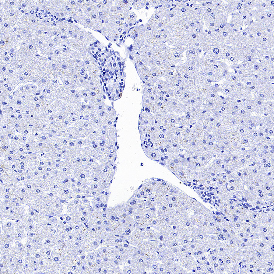 CDH17 Recombinant Rabbit mAb (SDT-3276-46)