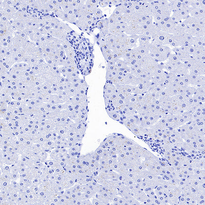 CDH17 Recombinant Rabbit mAb (SDT-3276-46)