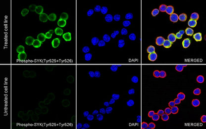 Phospho-Syk (Tyr525/526) Recombinant Rabbit mAb (S-1245-113)