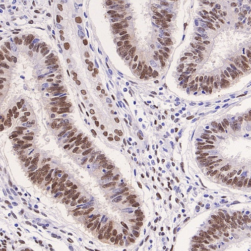 Phospho-ATF-2 (Thr71)/ATF-7 (Thr53) Recombinant Rabbit mAb (S-3535)