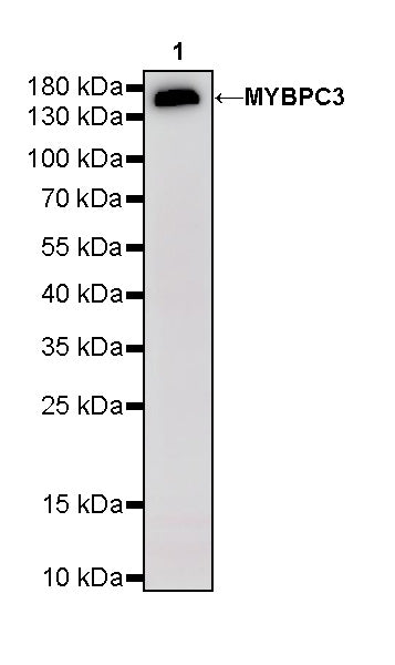 MYBPC3 Recombinant Rabbit mAb (S-5476)