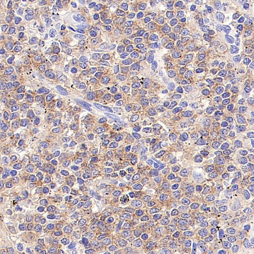 EBV Induced Gene 2/EBI2 Recombinant Rabbit mAb (S-5946)