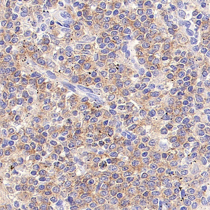 EBV Induced Gene 2/EBI2 Recombinant Rabbit mAb (S-5946)