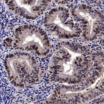 DLX5 Recombinant Rabbit mAb (S-2785-79)