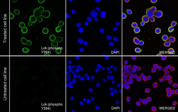 Phospho-Lck (Tyr394) Recombinant Rabbit mAb (S-1957-74)