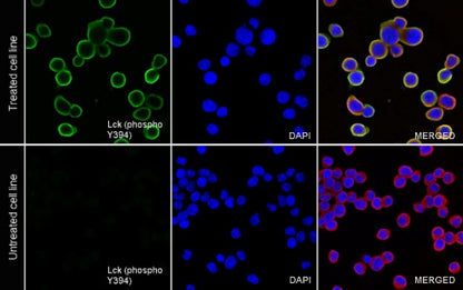 Phospho-Lck (Tyr394) Recombinant Rabbit mAb (S-1957-74)