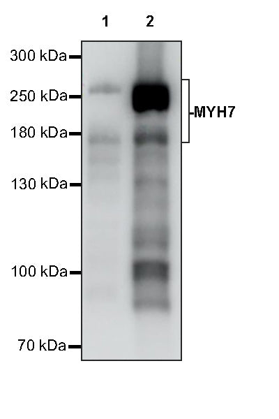 MYH7 Recombinant Rabbit mAb (S-4468-32)