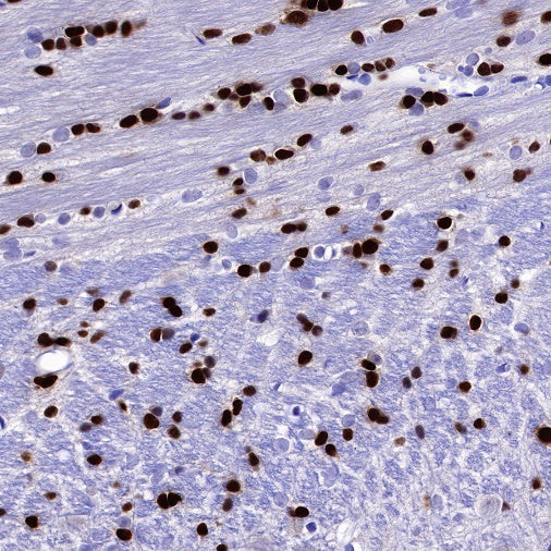 Olig2 Recombinant Rabbit mAb (SDT-648-155)